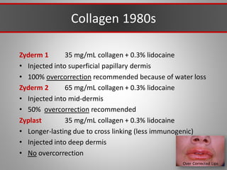Collagen 1980s
Zyderm 1 35 mg/mL collagen + 0.3% lidocaine
• Injected into superficial papillary dermis
• 100% overcorrection recommended because of water loss
Zyderm 2 65 mg/mL collagen + 0.3% lidocaine
• Injected into mid-dermis
• 50% overcorrection recommended
Zyplast 35 mg/mL collagen + 0.3% lidocaine
• Longer-lasting due to cross linking (less immunogenic)
• Injected into deep dermis
• No overcorrection
Over Corrected Lips
 