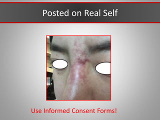 Posted on Real Self
Use Informed Consent Forms!
 