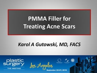 PMMA Filler for
Treating Acne Scars
Karol A Gutowski, MD, FACS
 