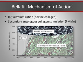 Bellafill Mechanism of Action
• Initial volumization (bovine collagen)
• Secondary autologous collagen stimulation (PMMA)
5 days 2 wks 1 mo 3 mo 5 mo 6 mo 1 yr 2 yr 3 yr
0%
20%
40%
60%
80%
100%
Percent
Implant
Volume
 