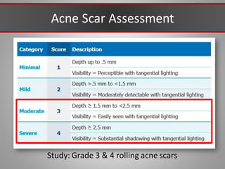 Acne Scar Assessment
Study: Grade 3 & 4 rolling acne scars
 