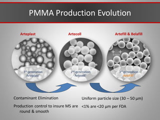 Arteplast Artecoll Artefill & Belafill
Contaminant Elimination
Production control to insure MS are
round & smooth
Uniform particle size (30 – 50 µm)
<1% are <20 µm per FDA
PMMA Production Evolution
 