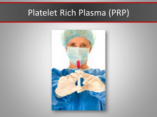 Platelet Rich Plasma (PRP)
 