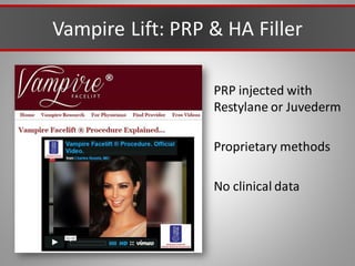 Vampire Lift: PRP & HA Filler
PRP injected with
Restylane or Juvederm
Proprietary methods
No clinical data
 