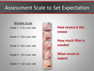 Assessment Scale to Set Expectation
Wrinkle Scale
Grade 1 ~ 0.3 cc per side
Grade 2 ~ 0.6 cc per side
Grade 3 ~ 0.6 cc per side
Grade 4 ~ 1.0 cc per side
Grade 5 ~ 1.0 cc per side
How severe is the
crease
How much filler is
needed
What result to
expect
 