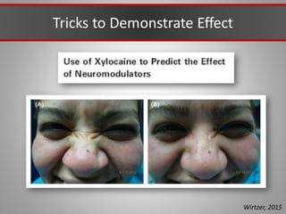 Tricks to Demonstrate Effect
Wirtzer, 2015
 