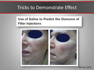 Tricks to Demonstrate Effect
Wirtzer, 2015
 
