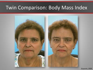 Twin Comparison: Body Mass Index
Guyuron, 2009
 