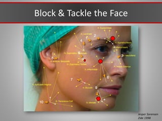 Block & Tackle the Face
Jesper Sorensen
Zide 1998
 