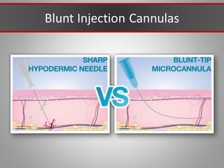 Blunt Injection Cannulas
 