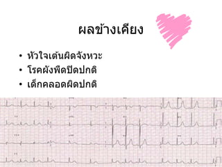 ผลข ้างเคียง
• หัวใจเต ้นผิดจังหวะ
• โรคผังพืดปิดปกติ
• เด็กคลอดผิดปกติ
 