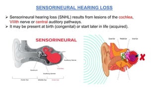 SENSORINEURAL HEARING LOSS
 Sensorineural hearing loss (SNHL) results from lesions of the cochlea,
VIIIth nerve or central auditory pathways.
 It may be present at birth (congenital) or start later in life (acquired).
 