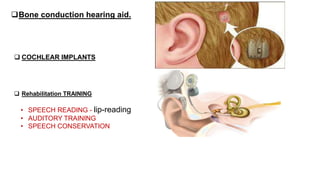 Bone conduction hearing aid.
 COCHLEAR IMPLANTS
 Rehabilitation TRAINING
• SPEECH READING - lip-reading
• AUDITORY TRAINING
• SPEECH CONSERVATION
 