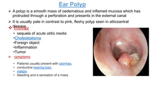 A polyp is a smooth mass of oedematous and inflamed mucosa which has
protruded through a perforation and presents in the external canal
Ear Polyp
 It is usually pale in contrast to pink, fleshy polyp seen in atticoantral
disease
 Etiology
• sequela of acute otitis media
•Cholesteatoma
•Foreign object
•Inflammation
•Tumor
 Symptoms
• Patients usually present with otorrhea,
• conductive hearing loss,
• otalgia,
• bleeding and a sensation of a mass
 