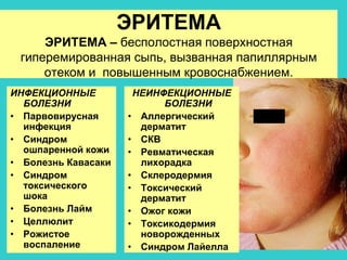 ЭКЗАНТЕМЫ.ppt