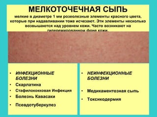 ЭКЗАНТЕМЫ.ppt