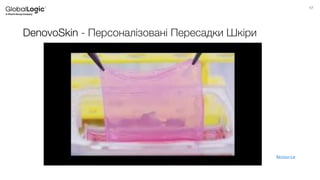 17
DenovoSkin - Персоналізовані Пересадки Шкіри
Resource
 