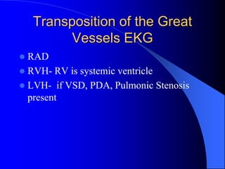 Transposition of the Great
Vessels EKG
 RAD
 RVH- RV is systemic ventricle
 LVH- if VSD, PDA, Pulmonic Stenosis
present
 