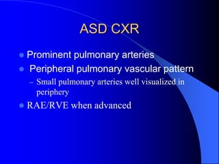ASD CXR
 Prominent pulmonary arteries
 Peripheral pulmonary vascular pattern
– Small pulmonary arteries well visualized in
periphery
 RAE/RVE when advanced
 