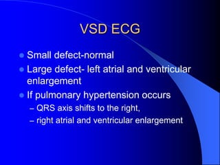 VSD ECG
 Small defect-normal
 Large defect- left atrial and ventricular
enlargement
 If pulmonary hypertension occurs
– QRS axis shifts to the right,
– right atrial and ventricular enlargement
 