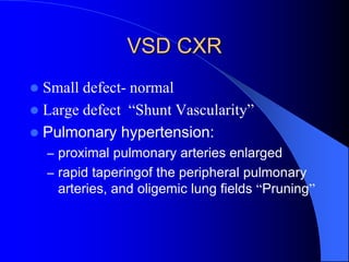 VSD CXR
 Small defect- normal
 Large defect “Shunt Vascularity”
 Pulmonary hypertension:
– proximal pulmonary arteries enlarged
– rapid taperingof the peripheral pulmonary
arteries, and oligemic lung fields “Pruning”
 
