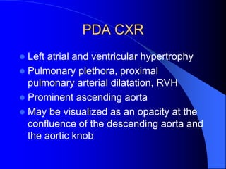 PDA CXR
 Left atrial and ventricular hypertrophy
 Pulmonary plethora, proximal
pulmonary arterial dilatation, RVH
 Prominent ascending aorta
 May be visualized as an opacity at the
confluence of the descending aorta and
the aortic knob
 