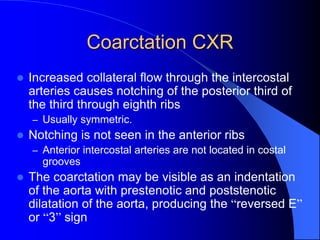 Coarctation CXR
 Increased collateral flow through the intercostal
arteries causes notching of the posterior third of
the third through eighth ribs
– Usually symmetric.
 Notching is not seen in the anterior ribs
– Anterior intercostal arteries are not located in costal
grooves
 The coarctation may be visible as an indentation
of the aorta with prestenotic and poststenotic
dilatation of the aorta, producing the “reversed E”
or “3” sign
 