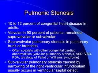Pulmonic Stenosis
 10 to 12 percent of congenital heart disease in
adults.
 Valvular in 90 percent of patients, remainder
supravalvular or subvalvular
 Supravalvular pulmonary stenosis in pulmonary
trunk or branches
– Often coexists with other congenital cardiac
abnormalities (valvular pulmonary stenosis, ASD, VSD,
PDA, tetralogy of Fallot or Williams syndrome)
 Subvalvular pulmonary stenosis caused by
narrowing of the right ventricular infundibulum
usually occurs in ventricular septal defect.
 