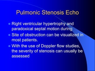 Pulmonic Stenosis Echo
 Right ventricular hypertrophy and
paradoxical septal motion during
 Site of obstruction can be visualized in
most patients.
 With the use of Doppler flow studies,
the severity of stenosis can usually be
assessed
 