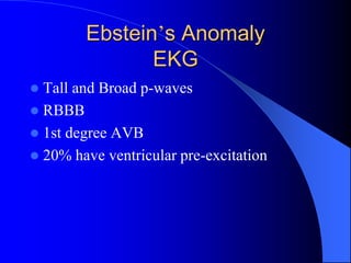 Ebstein’s Anomaly
EKG
 Tall and Broad p-waves
 RBBB
 1st degree AVB
 20% have ventricular pre-excitation
 