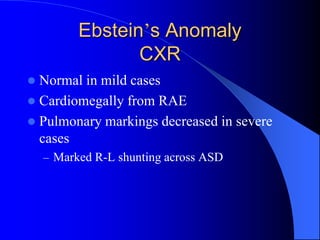 Ebstein’s Anomaly
CXR
 Normal in mild cases
 Cardiomegally from RAE
 Pulmonary markings decreased in severe
cases
– Marked R-L shunting across ASD
 
