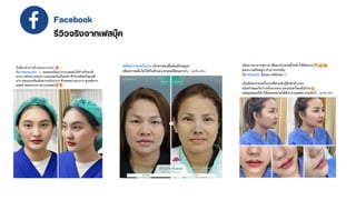 Facebook
รีวิวจริงจากเฟสบุ๊ค
 