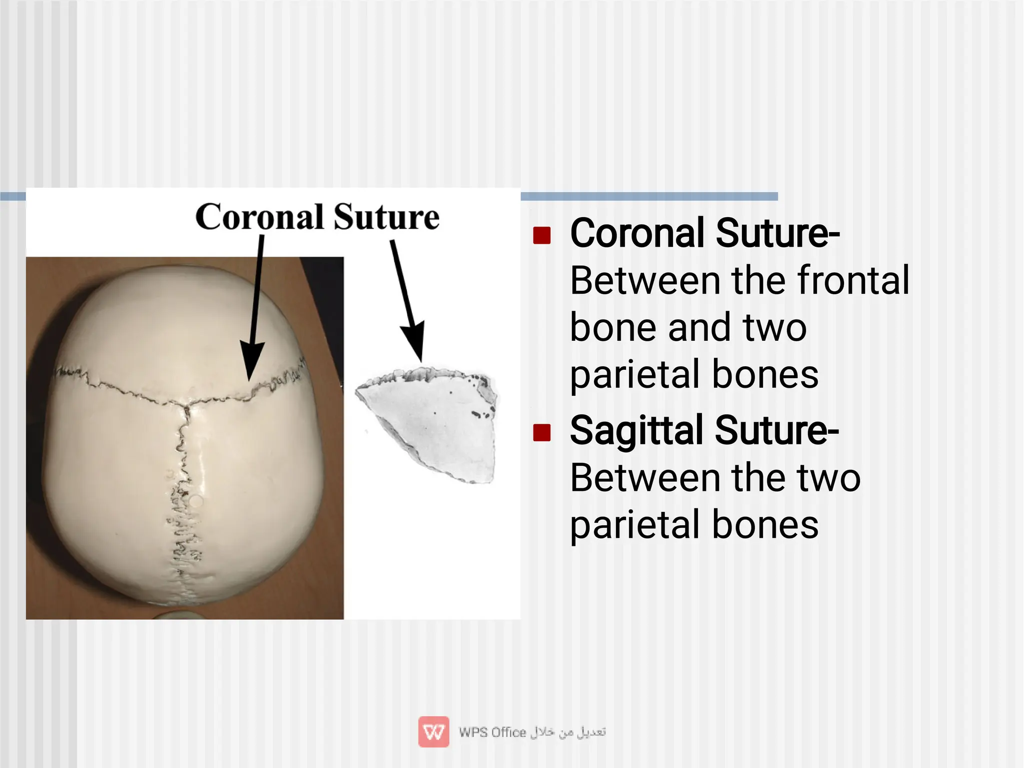 

Coronal Suture-
Between the frontal
bone and two
parietal bones
Sagittal Suture-
Between the two
parietal bones
 