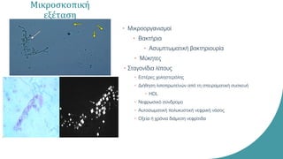 Μικροσκοπική
εξέταση
• Μικροοργανισμοί
• Βακτήρια
• Ασυμπτωματική βακτηριουρία
• Μύκητες
• Σταγονίδια λίπους
• Εστέρες χοληστερόλης
• Διήθηση λιποπρωτεϊνών από τη σπειραματική συσκευή
• HDL
• Νεφρωσικό σύνδρομο
• Αυτοσωματική πολυκυστική νεφρική νόσος
• Οξεία ή χρόνια διάμεση νεφρίτιδα
 