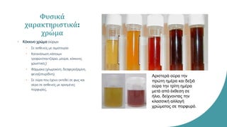 Φυσικά
χαρακτηριστικά:
χρώμα
• Κόκκινο χρώμα ούρων
• Σε ασθενείς με αιματουρία
• Κατανάλωση κάποιων
τροφών(παντζάρια, μούρα, κόκκινες
χρωστικές)
• Φάρμακα (χλωροκίνη, δεσφεριοξαμίνη,
φεναζοπυριδίνη)
• Σε ούρα που έχουν εκτεθεί σε φως και
αέρα σε ασθενείς με ορισμένες
πορφυρίες.
Αριστερά ούρα την
πρώτη ημέρα και δεξιά
ούρα την τρίτη ημέρα
μετά από έκθεση σε
ήλιο, δείχνοντας την
κλασσική αλλαγή
χρώματος σε πορφυρό.
 