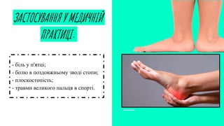ЗАСТОСУВАННЯ У МЕДИЧНІЙ
ПРАКТИЦІ:
- біль у п'ятці;
- болю в поздовжньому зводі стопи;
- плоскостопість;
- травми великого пальця в спорті.
 