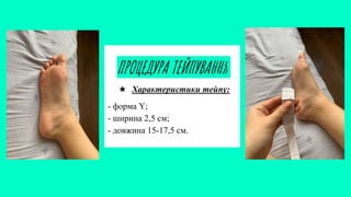ПРОЦЕДУРА ТЕЙПУВАННЯ
★ Характеристики тейпу:
- форма Y;
- ширина 2,5 см;
- довжина 15-17,5 см.
 