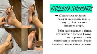 ПРОЦЕДУРА ТЕЙПУВАННЯ
➔ Положення пацієнта –
лежачи на животі, коліно
зігнуте, підошва ноги
дивиться вгору.
Тейп накладається з кінця,
починаючи з пальця. Потім,
витягується палець
максимально можливо, і тейп
накладається до кінця до п'яти.
 