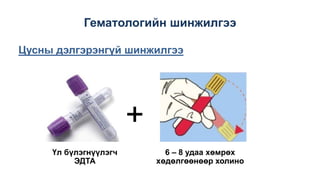 Гематологийн шинжилгээ
Цусны дэлгэрэнгүй шинжилгээ
+
6 – 8 удаа хөмрөх
хөдөлгөөнөөр холино
Үл бүлэгнүүлэгч
ЭДТА
 
