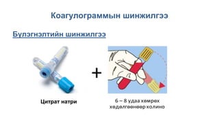 Коагулограммын шинжилгээ
Бүлэгнэлтийн шинжилгээ
+
Цитрат натри
 