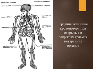 Средние величины
кровопотери при
открытых и
закрытых травмах
внутренних
органов
 