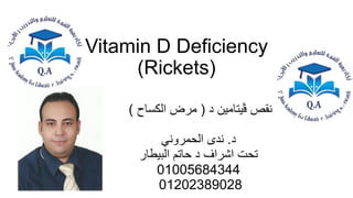 Vitamin D Deficiency
(Rickets)
‫د‬ ‫ڤيتامين‬ ‫نقص‬
(
‫الكساح‬ ‫مرض‬
)
‫د‬
.
‫ندى‬
‫الحمروني‬
‫حاتم‬ ‫د‬ ‫اشراف‬ ‫تحت‬
‫البيطار‬
01005684344
01202389028
 