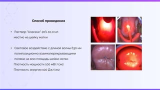 Способ проведения
• Раствор "Аласенс" 20% 10,0 мл
местно на шейку матки
• Световое воздействие с длиной волны 630 нм
полипозиционно взаимоперекрывающими
полями на всю площадь шейки матки
Плотность мощности 100 мВт/см2
Плотность энергии 100 Дж/см2
 