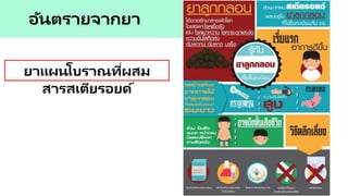 อันตรายจากยา
ยาแผนโบราณที่ผสม
สารสเตียรอยด์
 