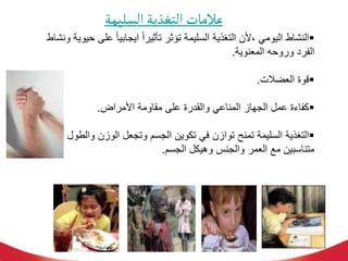 ‫السليمة‬‫التغذية‬‫عالمات‬

‫عل‬ ً‫ا‬‫ايجابي‬ ً‫ا‬‫تأثير‬ ‫تؤثر‬ ‫السليمة‬ ‫التغذية‬ ‫ألن‬، ‫اليومي‬ ‫النشاط‬
‫ونشاط‬ ‫حيوية‬ ‫ى‬
‫المعنوية‬ ‫وروحه‬ ‫الفرد‬
.

‫العضالت‬ ‫قوة‬
.

‫األمراض‬ ‫مقاومة‬ ‫على‬ ‫والقدرة‬ ‫المناعي‬ ‫الجهاز‬ ‫عمل‬ ‫كفاءة‬
.

‫وال‬ ‫الوزن‬ ‫وتجعل‬ ‫الجسم‬ ‫تكوين‬ ‫في‬ ‫توازن‬ ‫تمنح‬ ‫السليمة‬ ‫التغذية‬
‫طول‬
‫الجسم‬ ‫وهيكل‬ ‫والجنس‬ ‫العمر‬ ‫مع‬ ‫متناسبين‬
.
 
