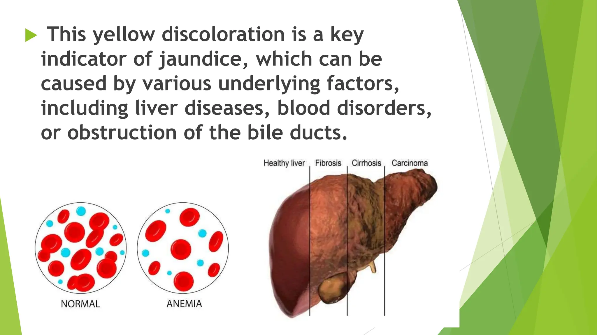 Yaraqn:causes, Classification and treatment | PPTX
