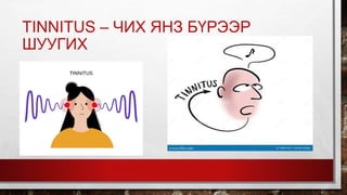 TINNITUS – ЧИХ ЯНЗ БҮРЭЭР
ШУУГИХ
 