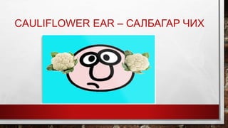 CAULIFLOWER EAR – САЛБАГАР ЧИХ
 