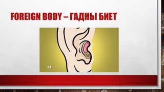 FOREIGN BODY – ГАДНЫ БИЕТ
 