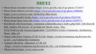 ΠΗΓΕΣ
• Photo from cottonbro studio: https://www.pexels.com/el-gr/photo/5721677/
• Photo from roberto carrafa: https://www.pexels.com/el-gr/photo/3908181/
• https://www.vecteezy.com/ Methylene Blue Stock
• Photo from Kindel Media: https://www.pexels.com/el-gr/photo/8326700/
• Photo from Elina Fairytale: https://www.pexels.com/el-gr/photo/6201973/
• Red blood cells from https://commons.wikimedia.org/w/index.php?title=File:Howell-
Jolly_bodies_(Overview_of_peripheral_blood_stain,_May-
Gr%C3%BCnwald_Giemsa).jpg&oldid=722619018 Creative Commons: Attribution –
Share Alike 4.0
• Onion cells from Viascos, CC BY-SA 4.0 <https://creativecommons.org/licenses/by-
sa/4.0>, via Wikimedia Commons
• Animal cells from ·: Jlipuma1, CC BY 4.0
<https://creativecommons.org/licenses/by/4.0>, via Wikimedia Commons
• Photos from https://www.canva.com
 